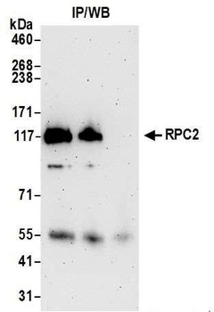 RPC2 Antibody