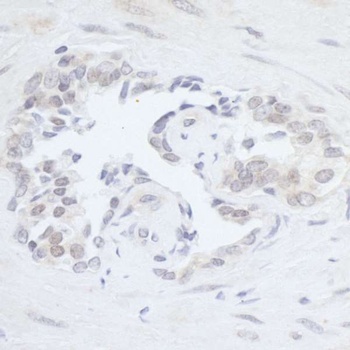 Rabbit anti-RPC2 Antibody