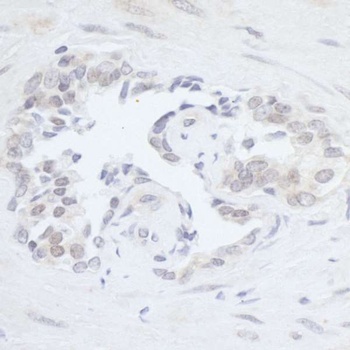 RPC2 Antibody