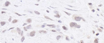 Rabbit anti-RPC2 Antibody