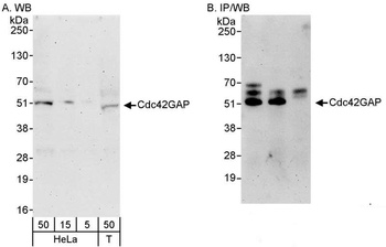 Rabbit anti-Cdc42GAP Antibody