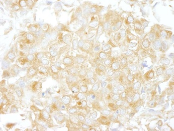 Rabbit anti-Cdc42GAP Antibody