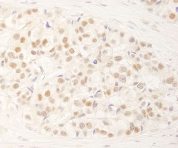 Rabbit anti-NRBF2 Antibody