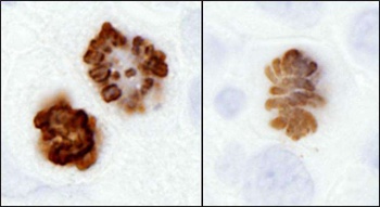 Rabbit anti-Phospho Histone H3 (S10) Antibody