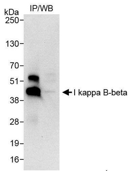 Rabbit I kappa B-beta Antibody