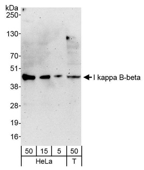 Rabbit I kappa B-beta Antibody