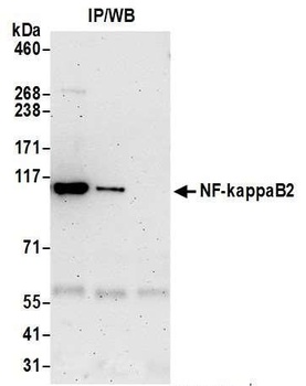 Rabbit anti-NF-kappaB2 Antibody