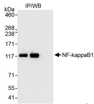 NF-kappaB1 Antibody