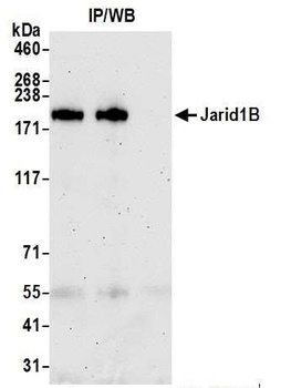 JARID1B Antibody