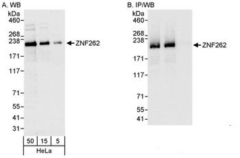Rabbit ZNF262 Antibody