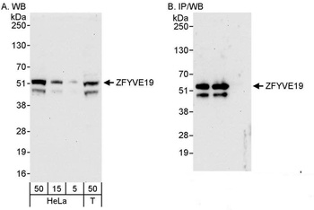 Rabbit ZFYVE19 Antibody