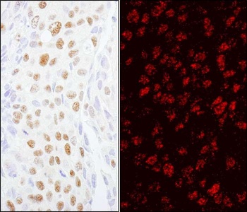 Rabbit anti-ZCCHC8 Antibody