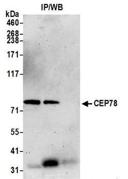 Rabbit anti-CEP78 Antibody