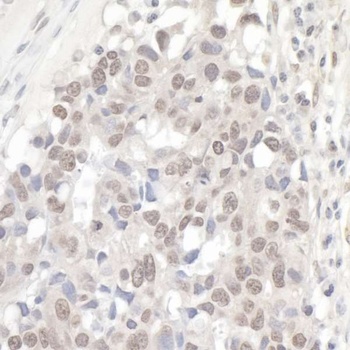 NCBP1/CBP80 Antibody