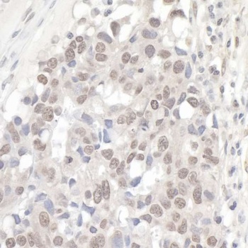 Rabbit anti-NCBP1/CBP80 Antibody