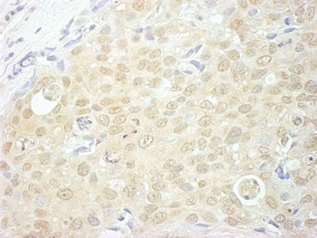 Rabbit anti-NCBP1/CBP80 Antibody