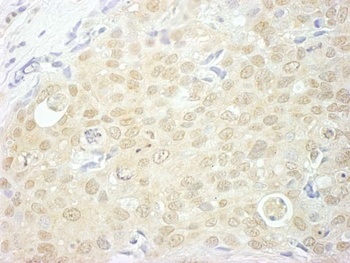 NCBP1/CBP80 Antibody