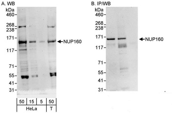 Rabbit NUP160 Antibody