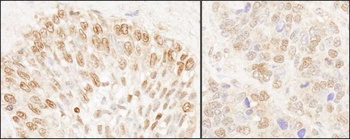 Rabbit anti-NUP50 Antibody