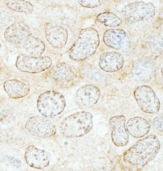 Rabbit anti-NUP50 Antibody