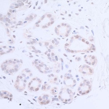Rabbit anti-XPA Antibody