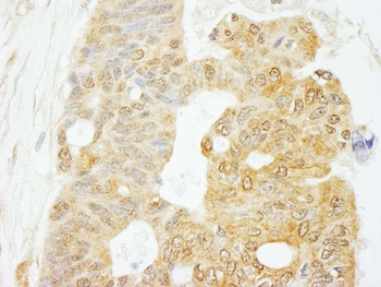 Rabbit anti-eIF4G1/eIF4GI Antibody