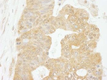 Rabbit anti-eIF4G1/eIF4GI Antibody