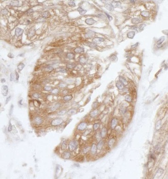 Rabbit anti-eIF3B/EIF3S9 Antibody