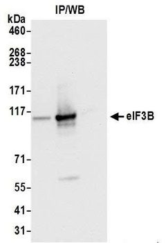 Rabbit anti-eIF3B/EIF3S9 Antibody
