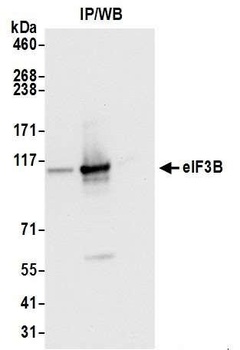 eIF3B/EIF3S9 Antibody