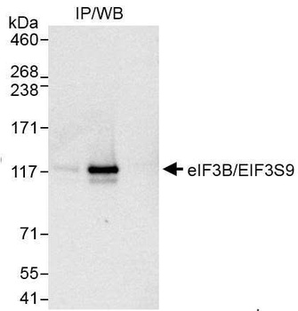 eIF3B/EIF3S9 Antibody