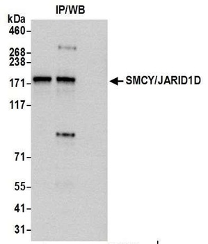 JARID1D/SMCY Antibody