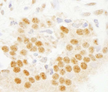 Rabbit anti-SET7 Antibody