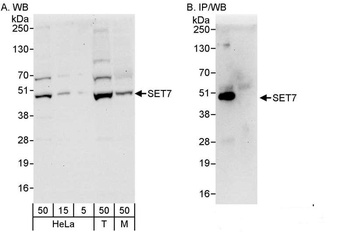 Rabbit anti-SET7 Antibody