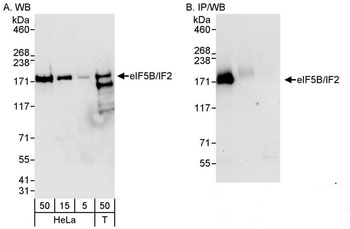 Rabbit anti-eIF5B/IF2 Antibody