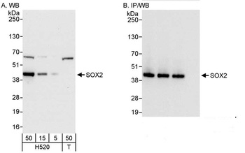 Rabbit SOX2 Antibody