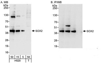Rabbit SOX2 Antibody