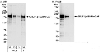 GRLF1/p190RhoGAP Antibody
