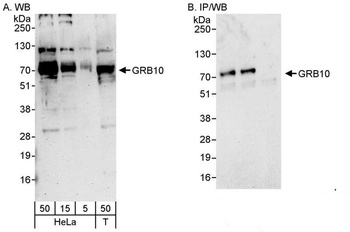 Rabbit GRB10 Antibody