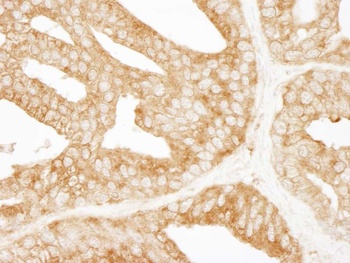 Rabbit anti-EPS15 Antibody