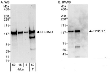 Rabbit EPS15L Antibody