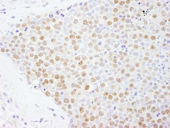 Rabbit anti-FOXK2 Antibody