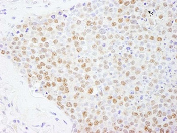 FOXK2 Antibody