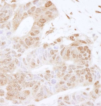 Rabbit anti-FOXK2 Antibody