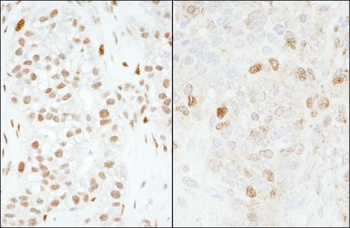 Rabbit anti-FOXK1 Antibody