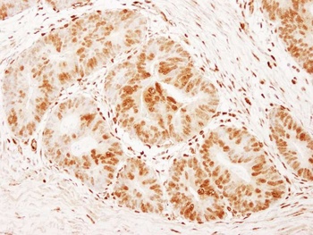 Rabbit anti-FOXK1 Antibody