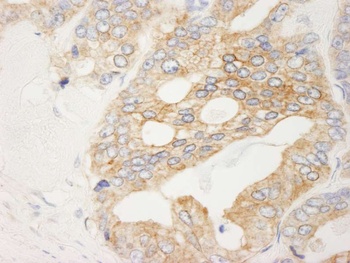 Rabbit anti-Filamin B Antibody