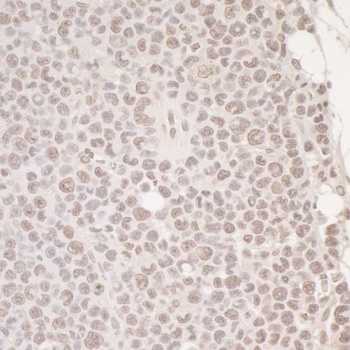 Rabbit anti-OCT1 Antibody