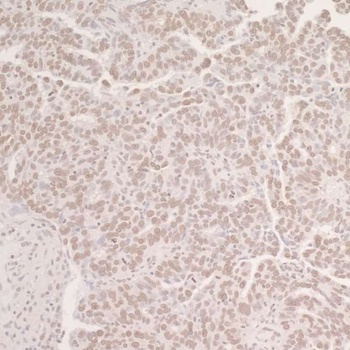 Rabbit anti-OCT1 Antibody