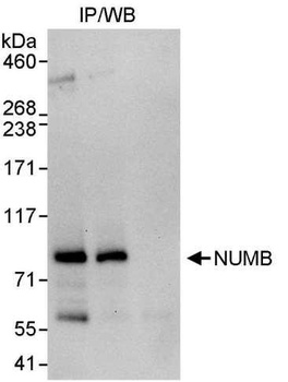 Rabbit NUMB Antibody